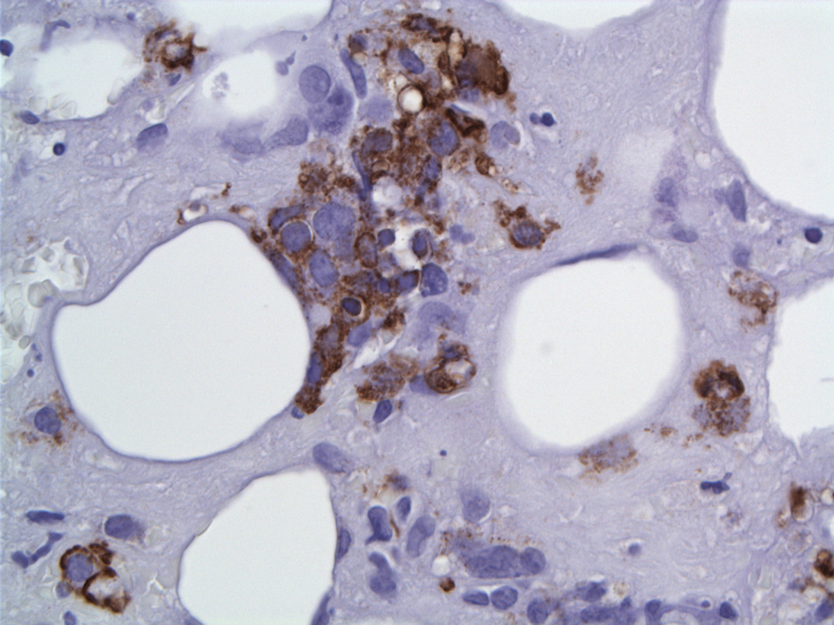 EMA labels few medium and large cells